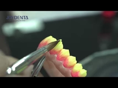 Indicazione dei denti anteriori Finiture dentali con spessore di 0,5 mm e perfetta permeabilità