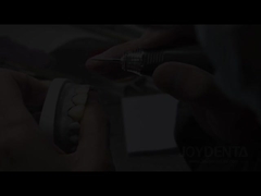 I rivestimenti per denti di scimmia: la soluzione perfetta per i rivestimenti dentali di trasparenza naturale