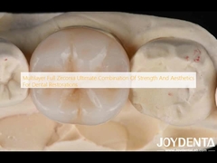 Multilayer Full Zirconia combinazione definitiva di forza ed estetica per la restaurazione dentale