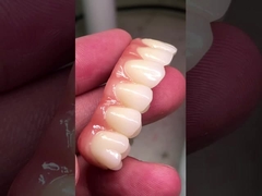 Ponte ibrida in zirconia a ti-bar di eccellente resistenza per la compatibilità di denti e gengive naturali