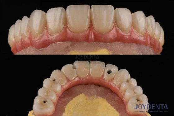 comprare Piattaforma di impianto dentale di superficie ruvida ponti dentali con connessione interna fabbricazione online
