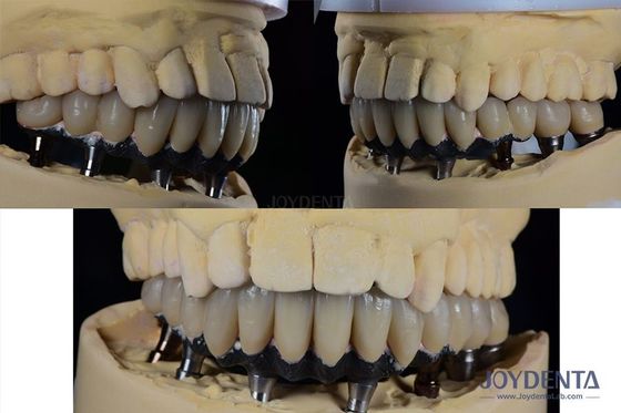 comprare Impianto dentale a denti multipli in titanio Chirurgia protesica Connessione esterno esagonale fabbricazione online