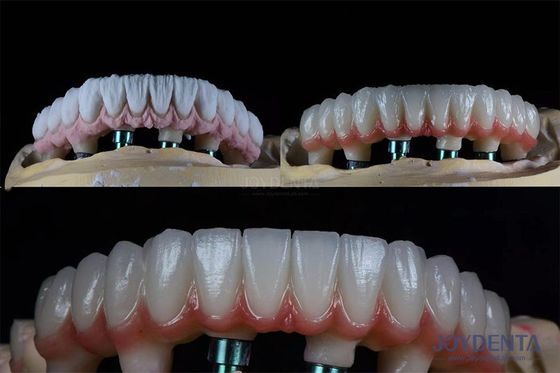 comprare 10 mm denti multipli due stadio kit di impianto dentale per corona protesica endosso fabbricazione online