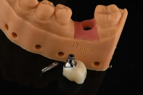 comprare Impianti di sostituzione dentale di argento cilindrico di precisione Restauro dentale fabbricazione online