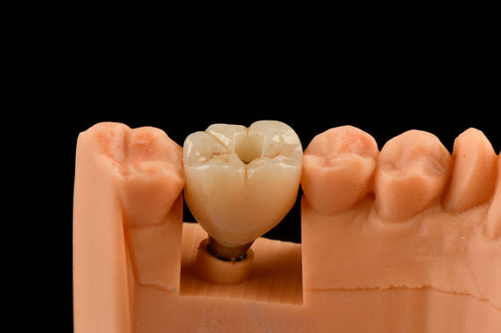 comprare Impianti dentali in titanio da 10 mm fabbricazione online