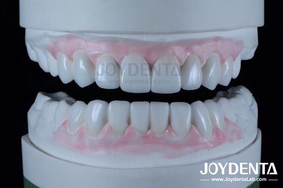 comprare Restituzioni dentali altamente accurate Cera in odontoiatria 1-2 mm di spessore fabbricazione online