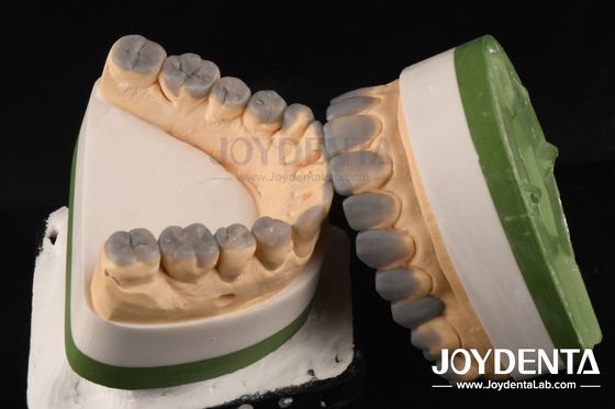 comprare Accuratezza elevata di cera dentale temporanea per la diagnosi personalizzata spessore 1-2 mm fabbricazione online