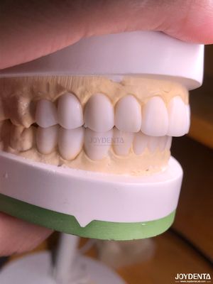 comprare Cere digitali di diagnosi personalizzate per la replicazione dell'anatomia naturale dei denti fabbricazione online