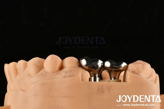 comprare Impianto dentale d'argento Abutments Diametro personalizzabile Altezza Tecnologia CAD CAM fabbricazione online