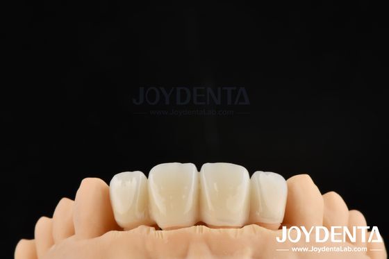 comprare Tecnica di preparazione orientata biologicamente BOPT per una preparazione dentale accurata fabbricazione online