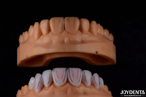 comprare Finiture in ceramica Emax dentistiche su misura con alto lucentezza resistente alle macchie fabbricazione online
