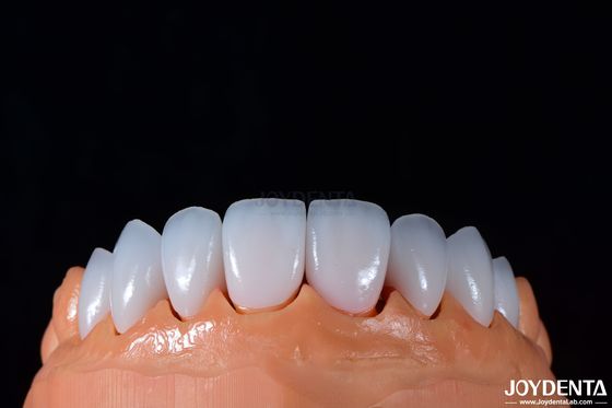 comprare 0.3-0.5 mm Spessore Finitura di porcellana Emax per odontoiatria cosmetica ad alto lucido fabbricazione online