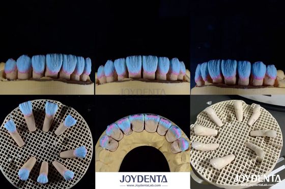 comprare Alta biocompatibilità Finitura ceramica feldspatica lucida per restauri dentali fabbricazione online