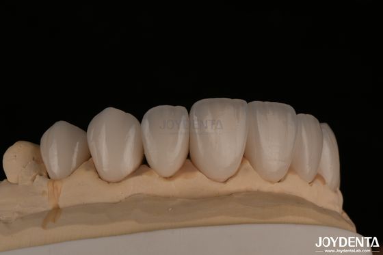 comprare Feldspathic Naturalmente apparente Finiture cosmetiche Precise Fit Altamente traslucide fabbricazione online