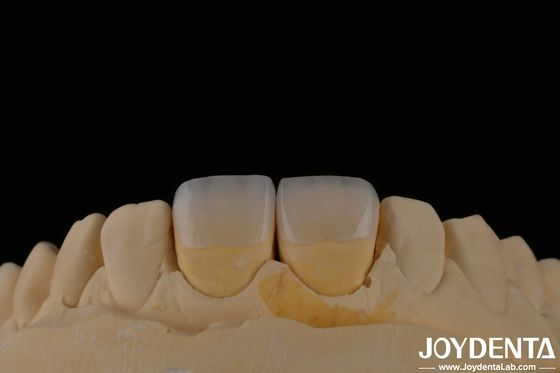 comprare Dental Fieldspathic Veneer di lunga durata Colore naturale dei denti Aspetto trasparente fabbricazione online