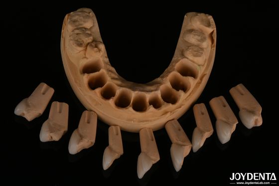 comprare Finitura dentale feldspatica ad adattamento preciso altamente naturale con una consistenza superficiale lucida fabbricazione online