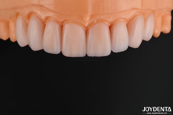 comprare Vernice in vetro ceramica personalizzabile dall'aspetto naturale ad alta resistenza chimica fabbricazione online