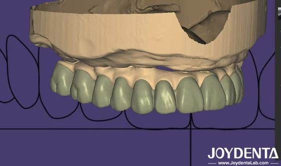 comprare Progettazione personalizzata di laboratorio di diagnostica digitale Wax Up Software integrazione senza soluzione di continuità fabbricazione online
