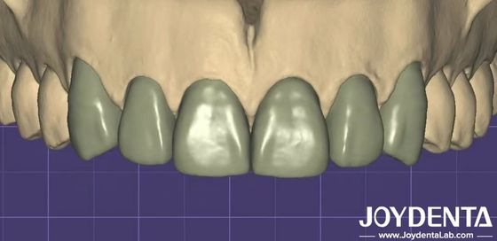 comprare Stampa 3D Virtual Digital Wax Up Compatibilità senza soluzione di continuità con altri software dentali fabbricazione online