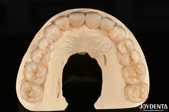 comprare Alta resistenza alla corrosione, zirconia completa il materiale preferito per i restauri dentali bianchi fabbricazione online