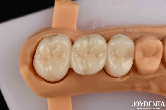 comprare Alta resistenza flessibile Zirconia a contorno completo per corone ponti restauro dentale fabbricazione online