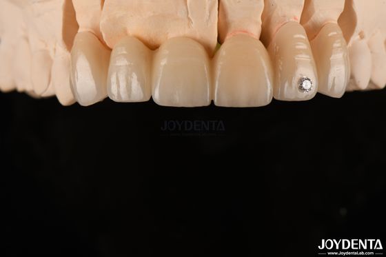 comprare CAD / CAM fresatura dentale zirconia stratificata per corone singole spessore dello strato 0,3-0,5 mm fabbricazione online