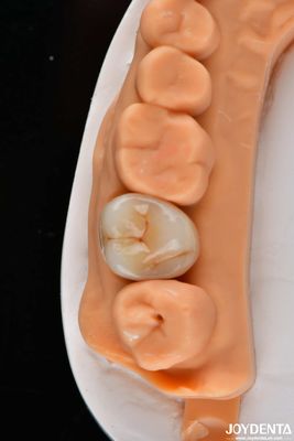 comprare Dental Multilayer Full Zirconia Corone E Ponte Alto Traslucido Aspetto naturale fabbricazione online