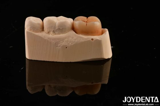 comprare Materiale per il restauro dentale multilivello Zirconia completa 1200 HV Durezza resistenza alle crepe fabbricazione online