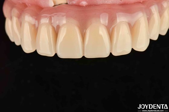 comprare Asciugatura rapida 5 minuti Finitura acrilica per i denti per la restaurazione dei denti dentali fabbricazione online