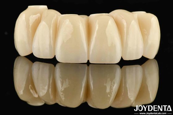 comprare Restauro dentale Ponte ibrida in zirconia a base di Ti fabbricazione online