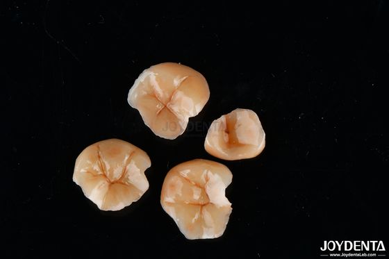 comprare Forma personalizzabile Infissi e infissi compositi Resistenza alle macchie dentali Durata fabbricazione online