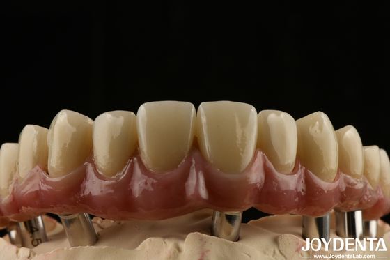comprare Titanio Malong Dental Hybrid Bridge Durable Adjusted Fit Low Density fabbricazione online