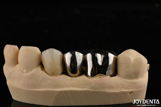 comprare Corona in lega di metallo resistente all'abrasione per restauri dentali personalizzati fabbricazione online