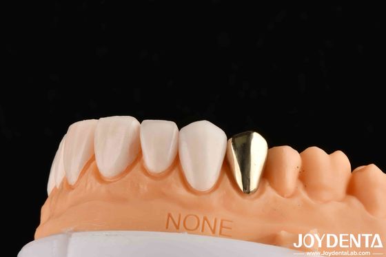 comprare Corone dentali metalliche in oro 60K resistenti all'abrasione fabbricazione online
