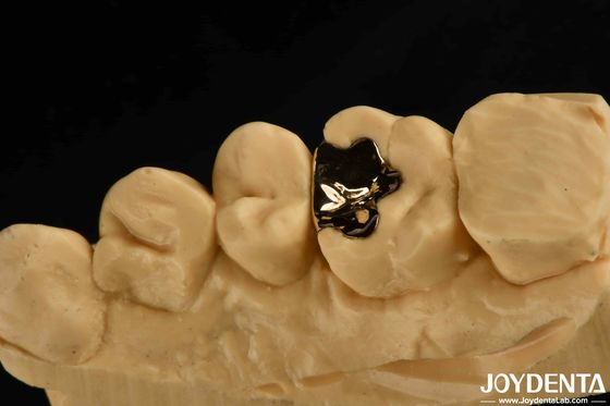 comprare Crona di oro dentale clinica metallica 60K cappuccio dentale d' oro per la riabilitazione orale fabbricazione online