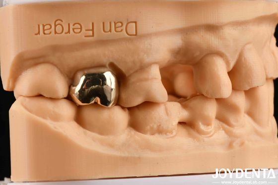 comprare Materiali dentali a colata di cera resistenti all'abrasione per una migliore riabilitazione orale fabbricazione online