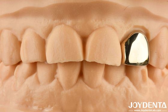 comprare Oro 60K Corona orale metallica resistente all'abrasione Corona dentale in cera fabbricazione online