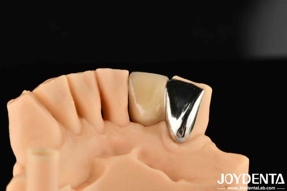 comprare Metallo dentale / Maryland Bridege Riparazione clinica orale Metallico Colore ideale Collegamento clinico fabbricazione online
