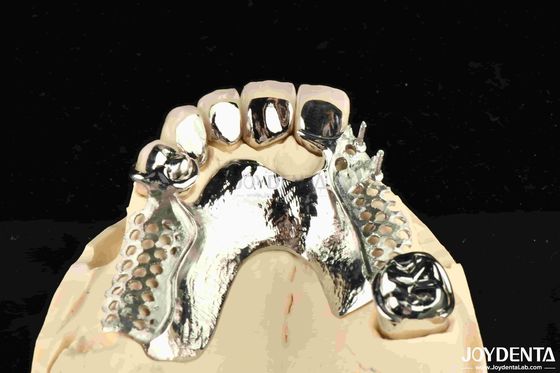comprare Legatura di metallo Quadro dentale rimovibile indossabile per i dentisti fabbricazione online