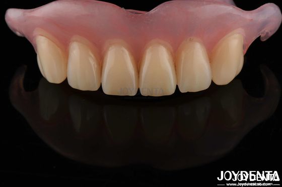 comprare Denti rimovibili flessibili, confortevoli, con un laboratorio dentale. fabbricazione online