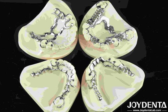 comprare Good Fit Dental Metal Frame Materiale metallico per restauri dentali durevoli fabbricazione online