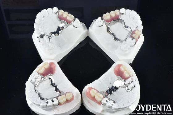 comprare Elaborare un quadro tecnologico per la finitura dei denti per una struttura orale stabile fabbricazione online