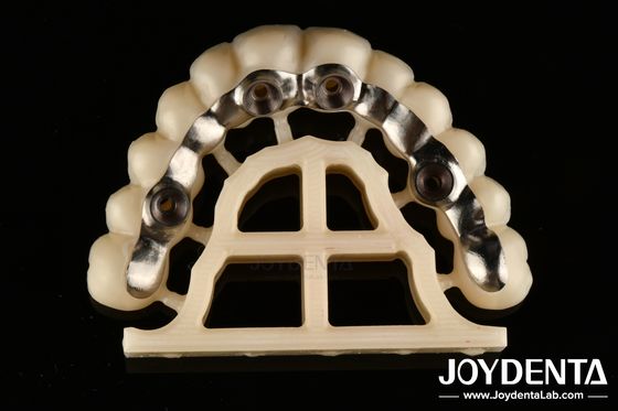 comprare Finitura in argento Abutments e barre personalizzate ad accuratezza fabbricazione online