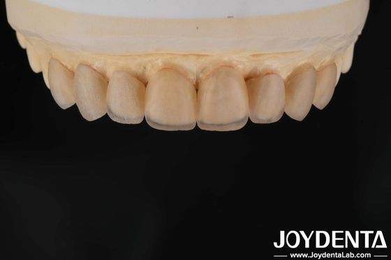 comprare Aspetto naturale Finiture in vetro ceramiche, finiture per clinica dentale Legame forte fabbricazione online