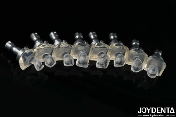 comprare Vernice per denti di vetro in porcellana altamente traslucida Alta resistenza 0,3-0,8 mm Spessore fabbricazione online