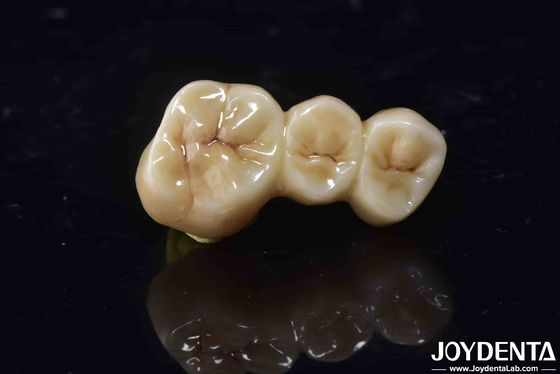 comprare Alta biocompatibilità Coroa di zirconia a contorno completo Perfetta vestibilità Alta resistenza fabbricazione online