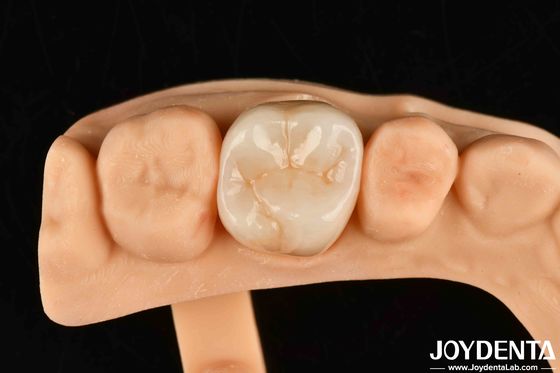comprare Alto resistenza all'usura Dental Full Zirconia Alta resistenza Full Contour Zirconia Bridge fabbricazione online