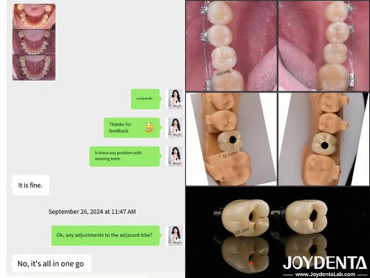 comprare Impianti dentali ad arco completo di lunga durata Lungozza dell'impianto endosseo 10 mm-16 mm fabbricazione online