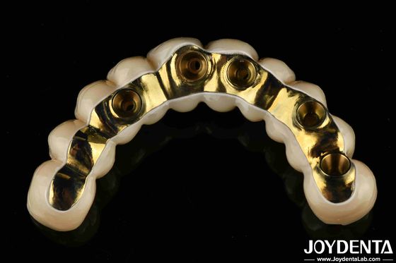 comprare Protesi dentale a base di zirconia di ti-bar. fabbricazione online