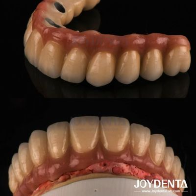 comprare Fusione e fresatura PFM Corona dentale, Restaurazioni dentali Corona metallica fusa in porcellana fabbricazione online
